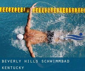 Beverly Hills Schwimmbad (Kentucky)