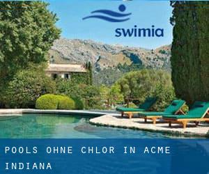 Pools-ohne-chlor in Acme (Indiana)